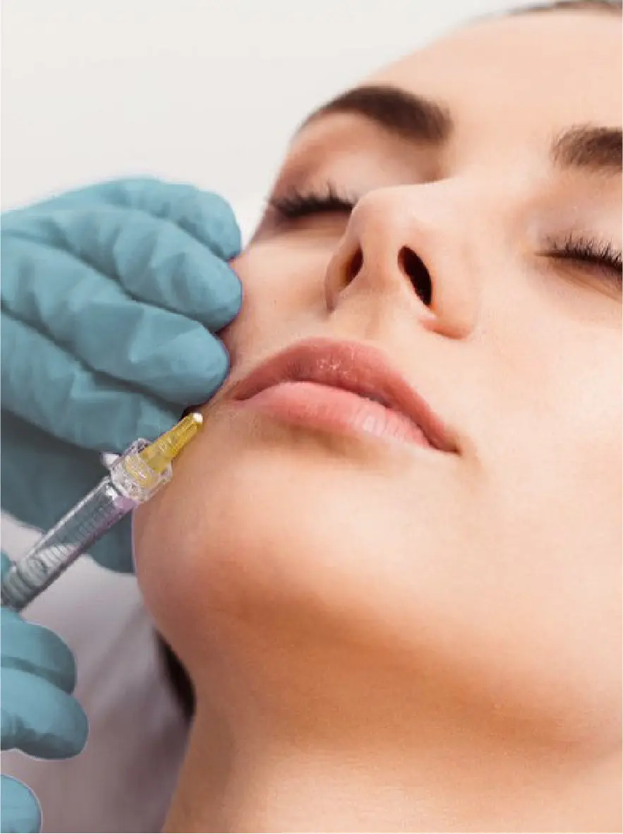 botox filler