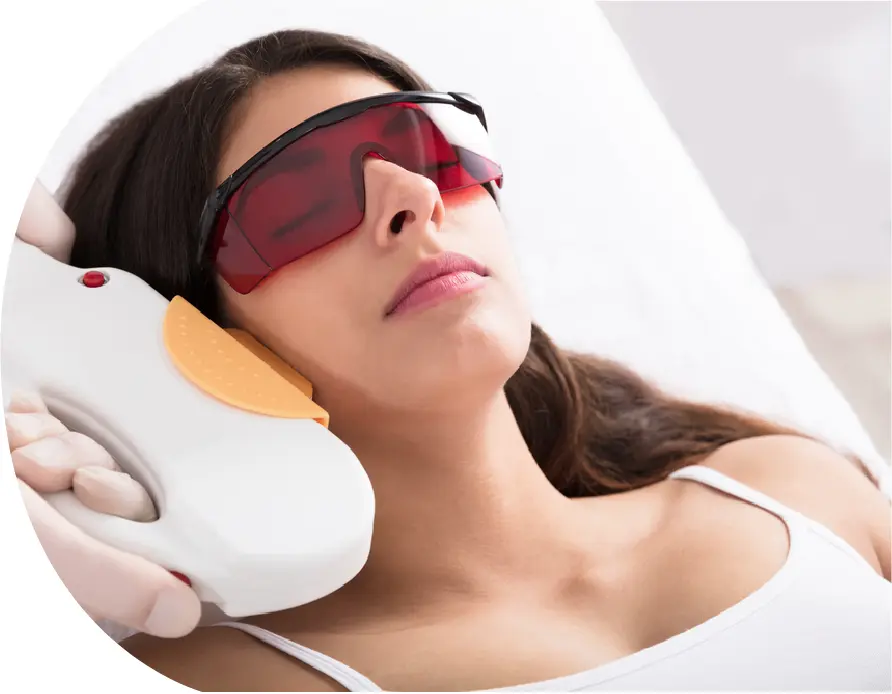 ipl laser treatment ipl laser treatment