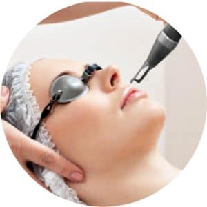 laser co2 FRACTIONAL