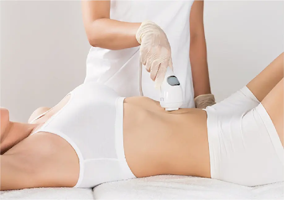 laser rejuvenation body laser rejuvenation body