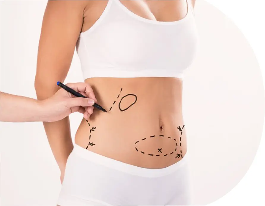 LYPOLYSIS LYPOLYSIS