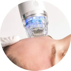 secret needle secret needle
