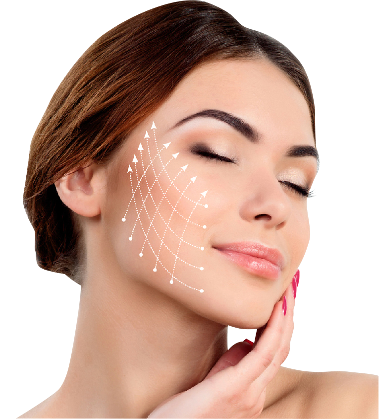 thread lift