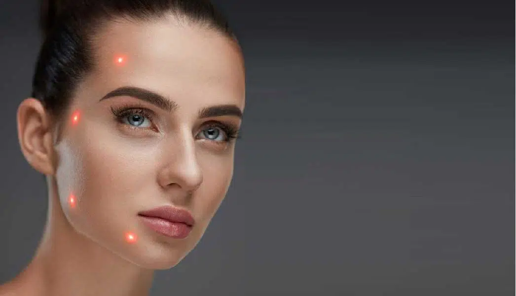 Laser Treatment Pico