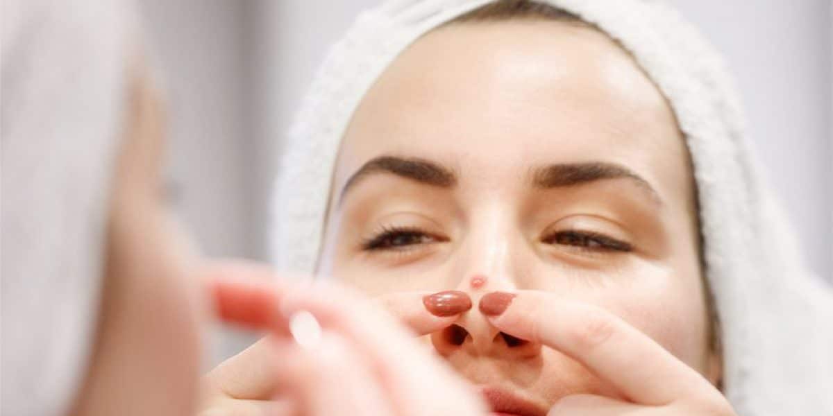 Cara Menghilangkan Jerawat Hidung