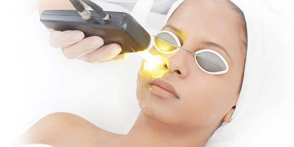 Yellow Laser Skin Treatment terbaik utk kulit anda