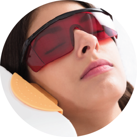 IPL laser (1)