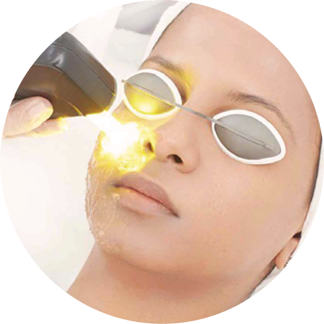 Yellow Laser