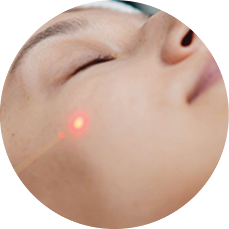 endo laser