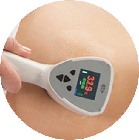 exilis