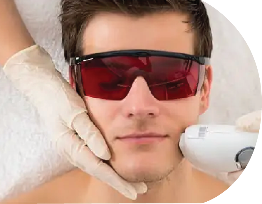 hair removal laser