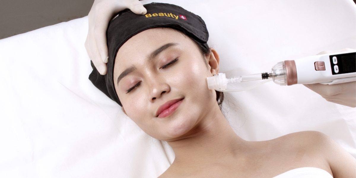 Proses treatment Secret Needle RF Microneedling di Beauty Plus Clinic untuk bopeng dan bekas jerawat